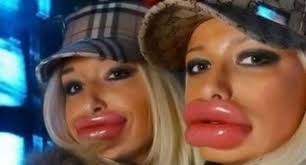 ugly lips ...