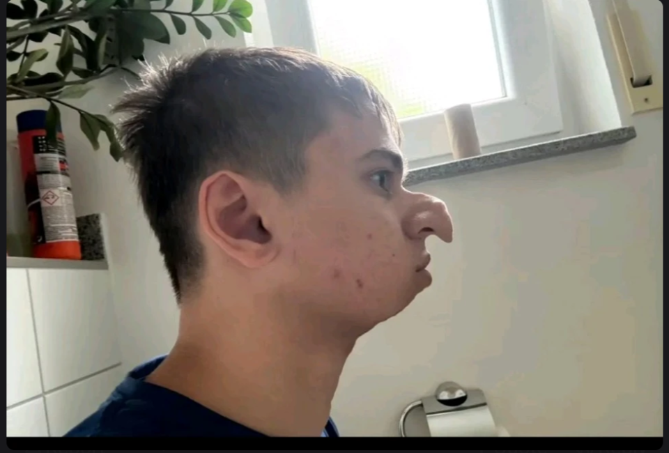 1000004643