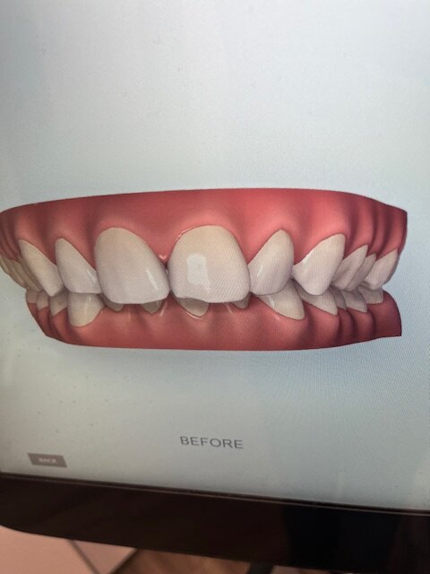 Image0