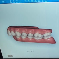 Image4