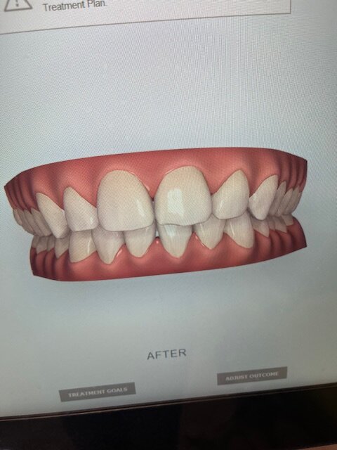 Image3