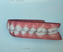 Image2