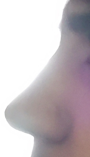 Screenshot 20260413 101539 com snapchat android MainActivity