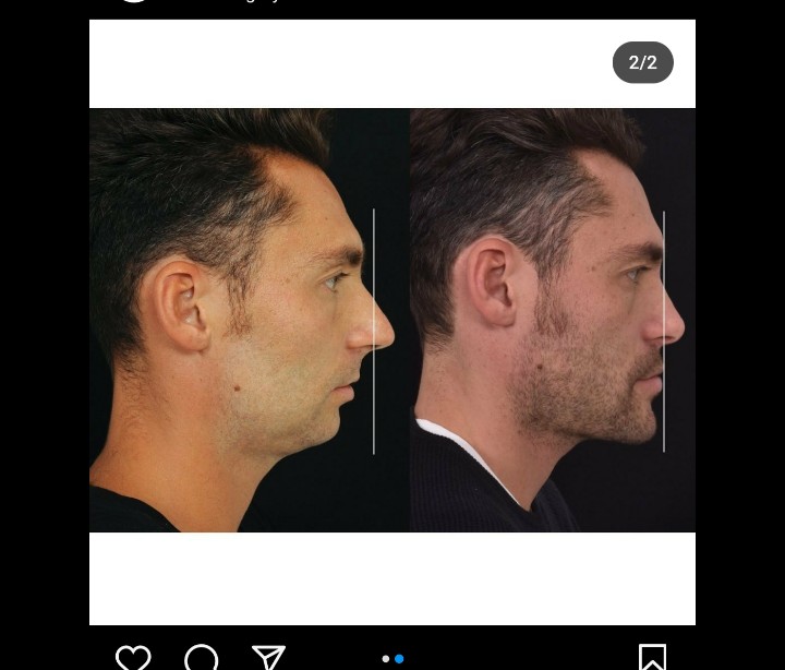 1000008985