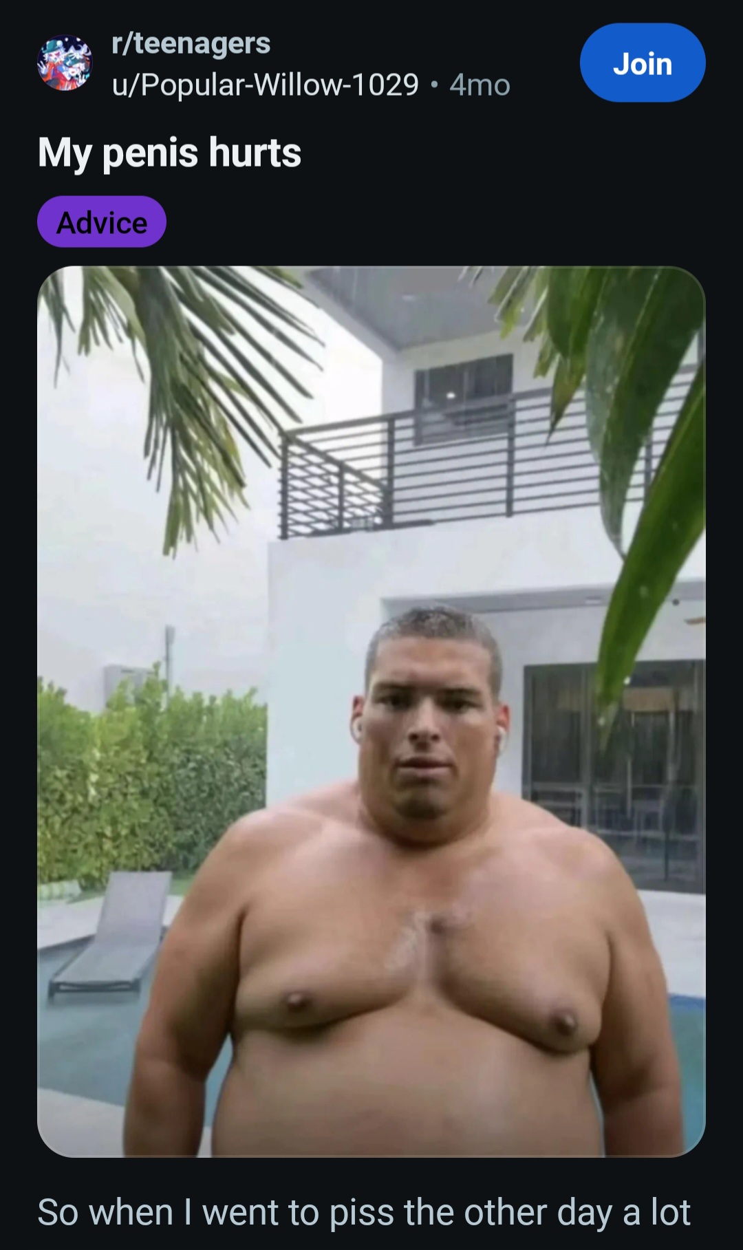 Screenshot 20260413 192417 Reddit