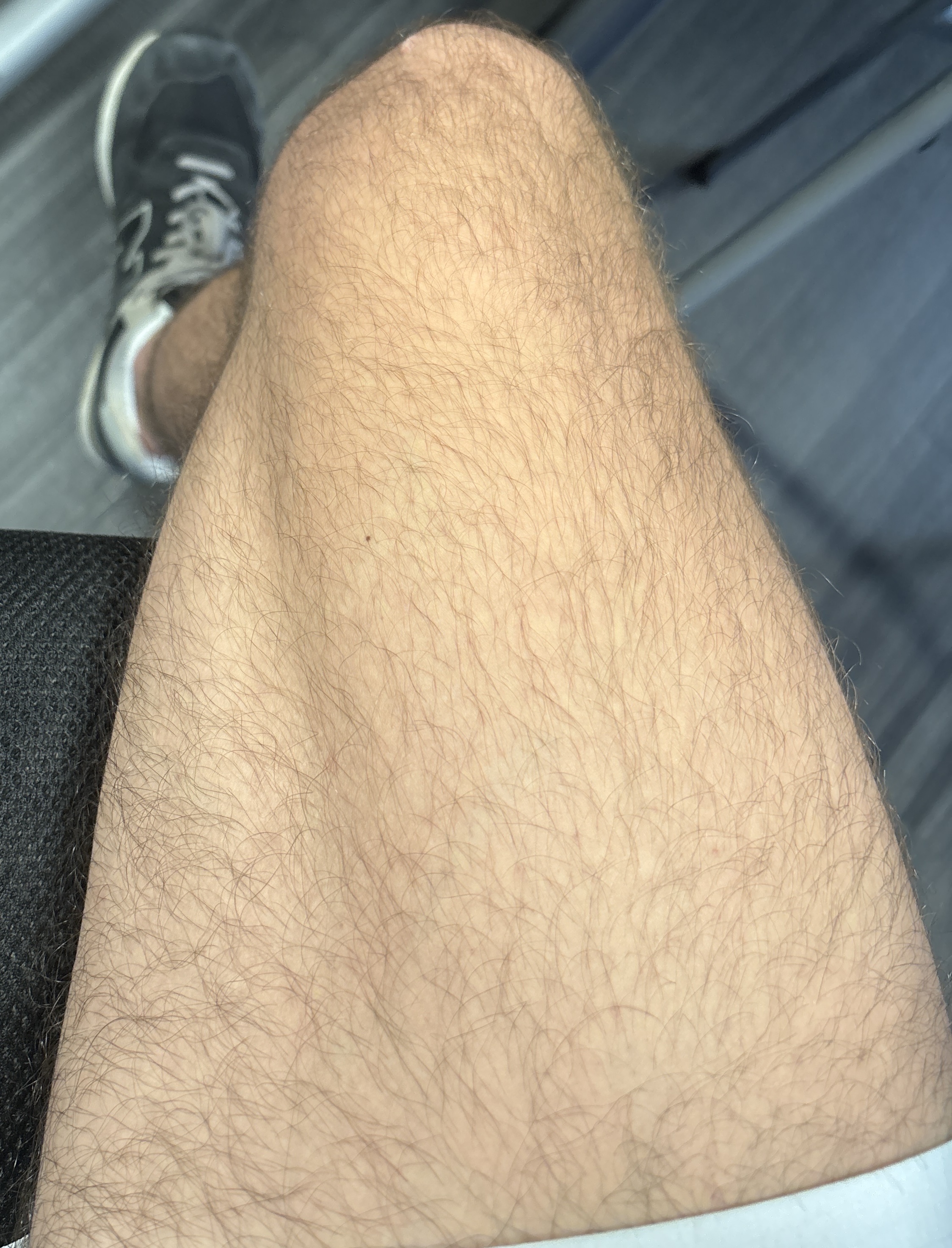 IMG 8CF43578 C3E0 47B6 B7A6 BCA17310C507