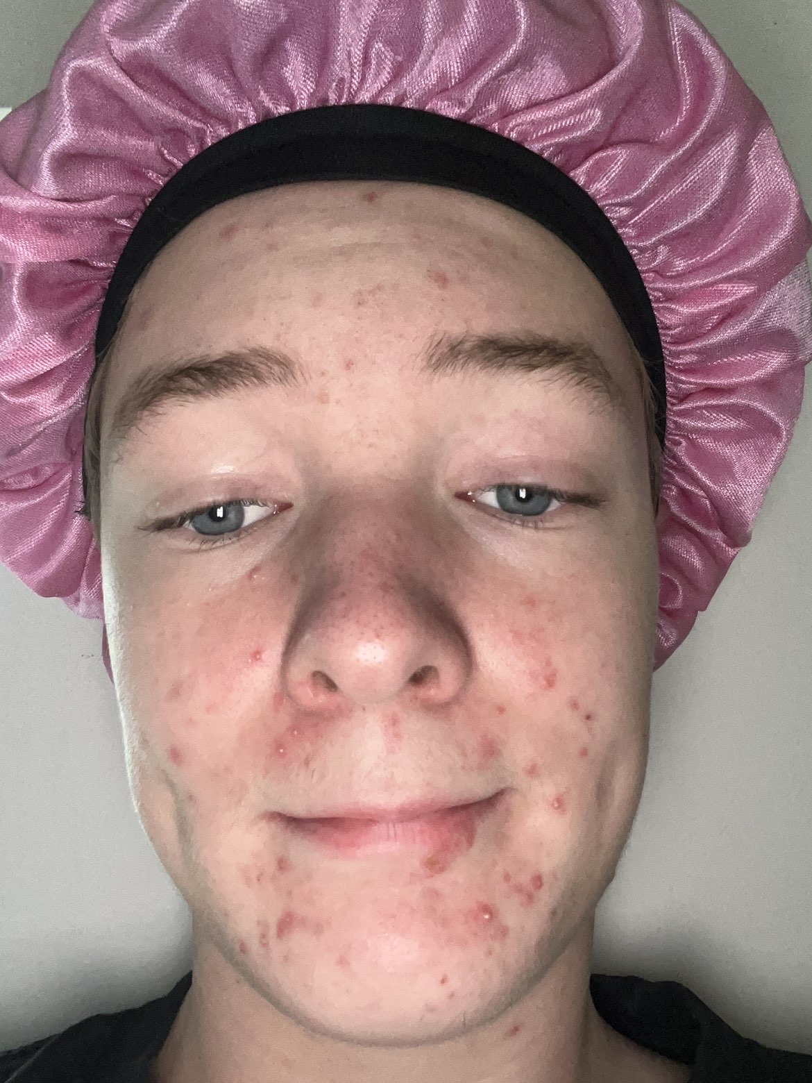IMG 0218