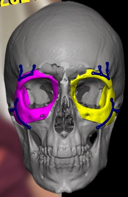 Screenshot 2026 04 15 at 15 34 56 orbital box osteotomy at DuckDuckGo