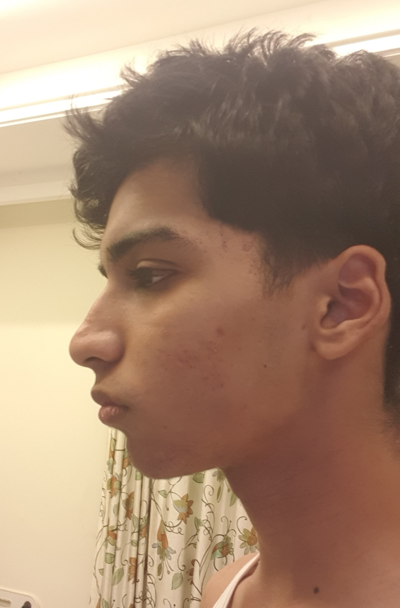 20260415 191133