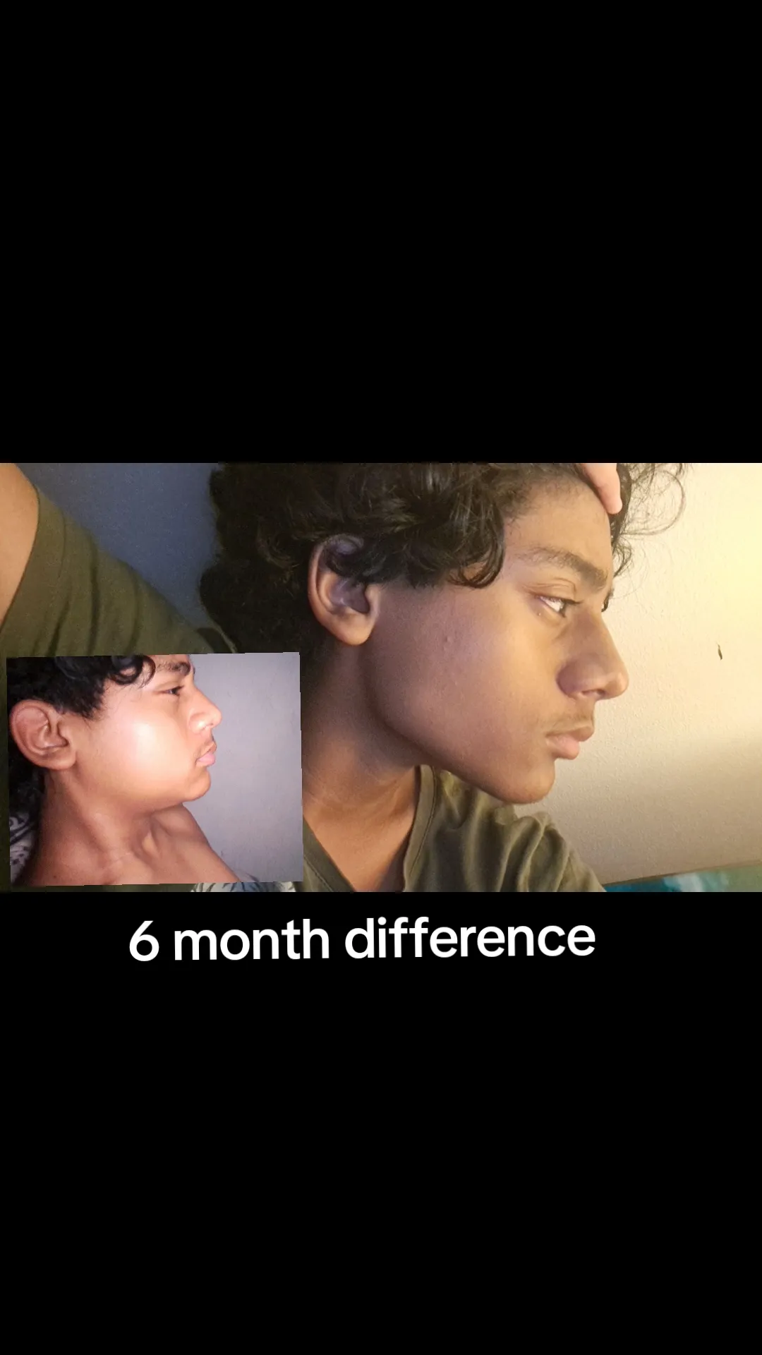 1000209166