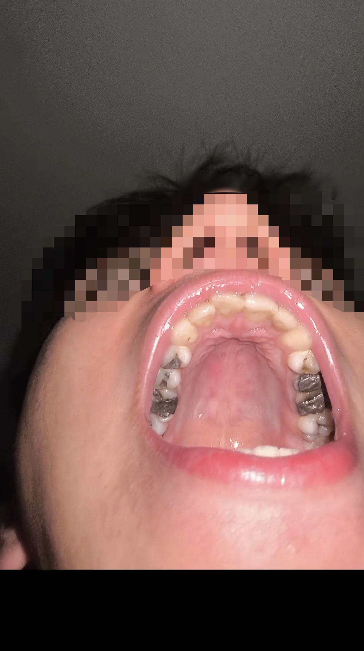 21196