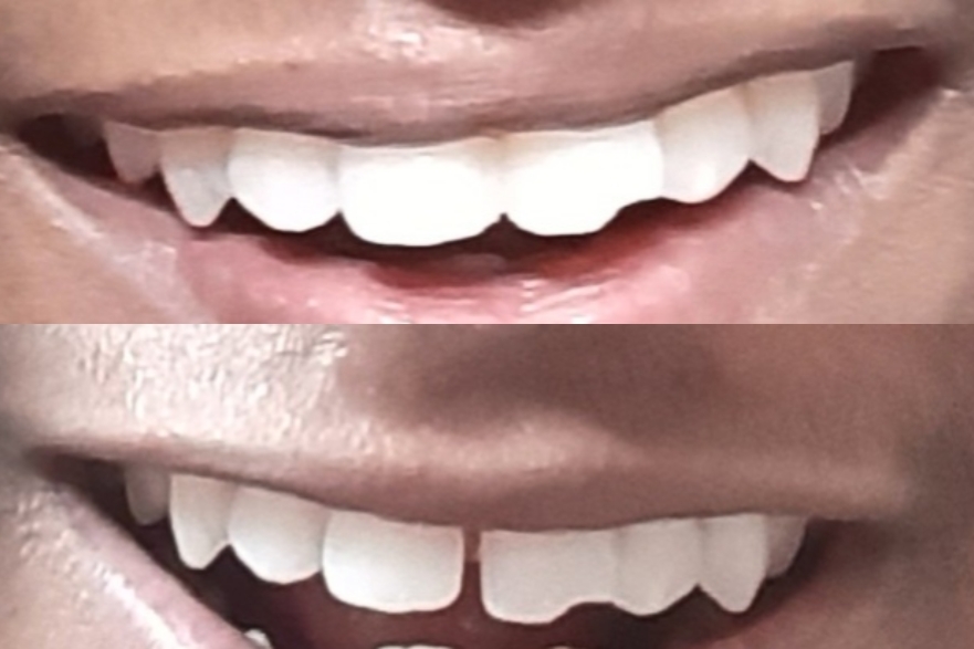 Retouch 2026041621205189