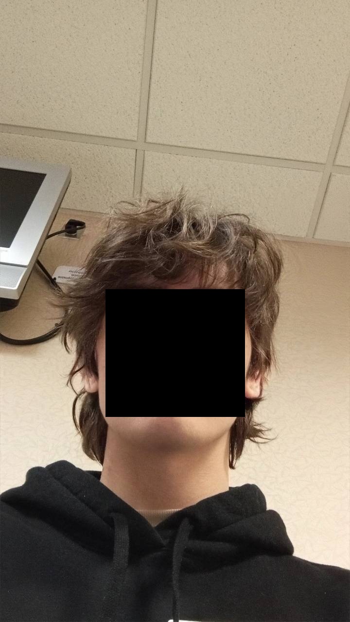 Hair