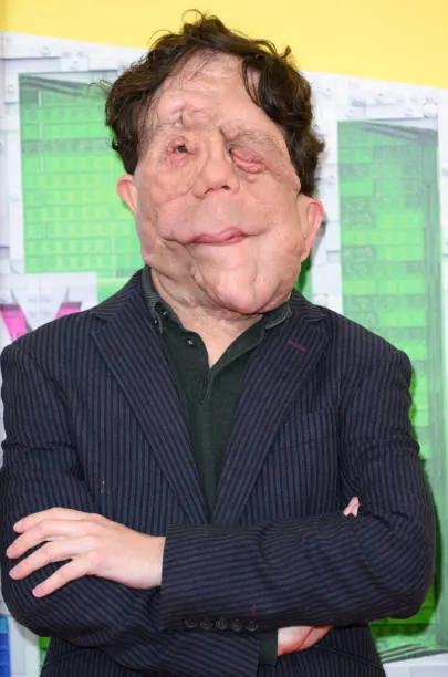 London england adam pearson attends the piece by piece closing night headline gala during the