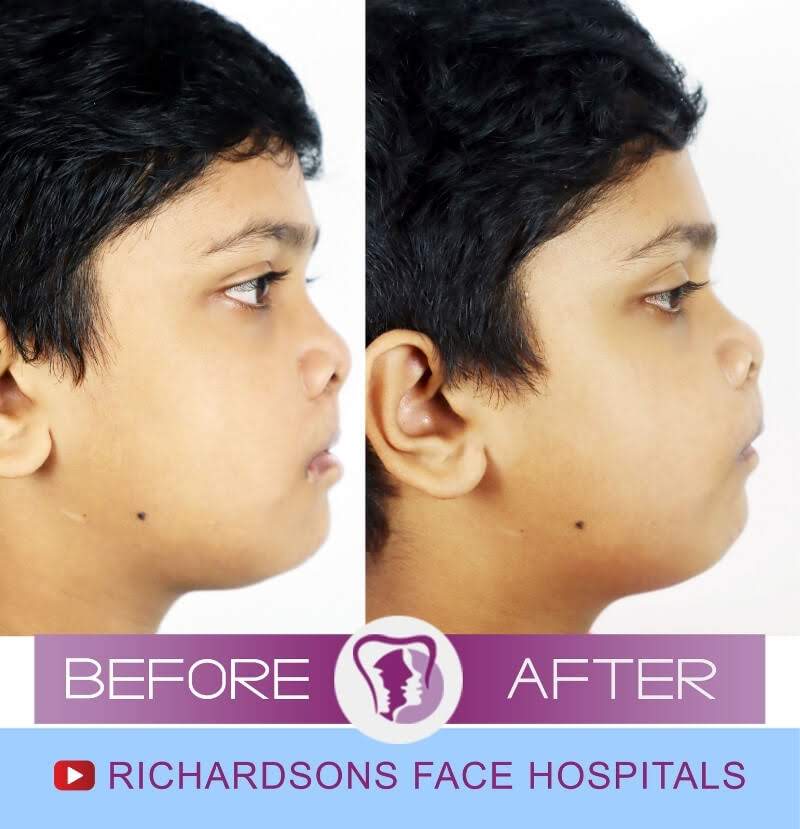 Ab54a200 ba66 4d6d 9559 fb61925cb158 1 all 42886