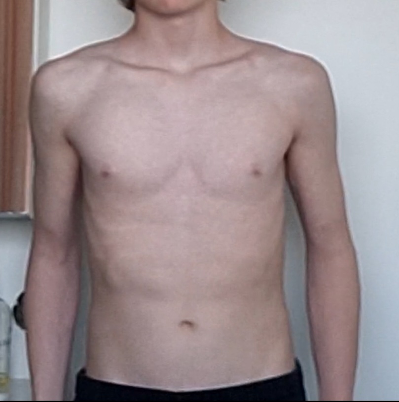 6155357 Screenshot 20260418 193353 Snapchat