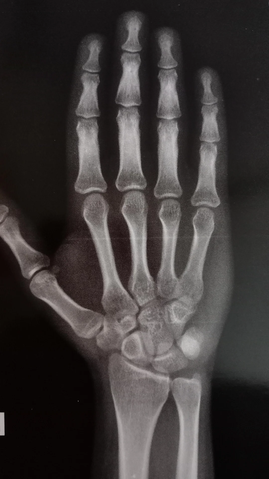 Are my growth plates closed im 20m v0 r38snq0pjkhc1