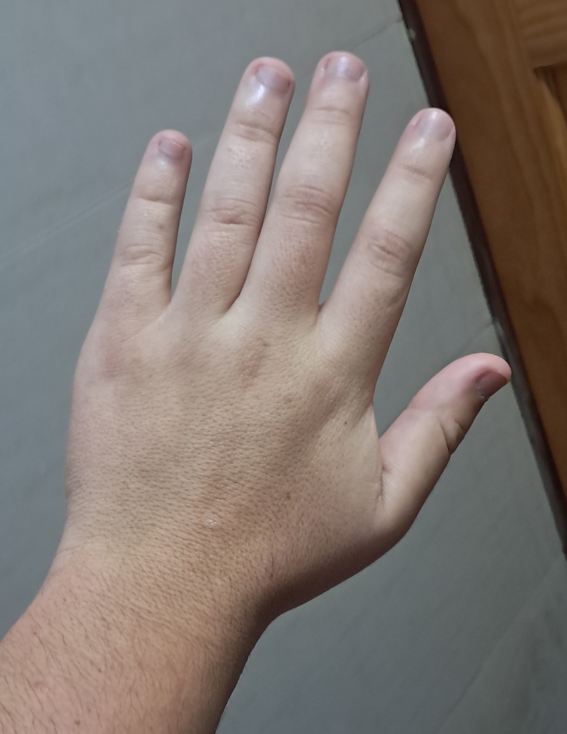 20260411 172254