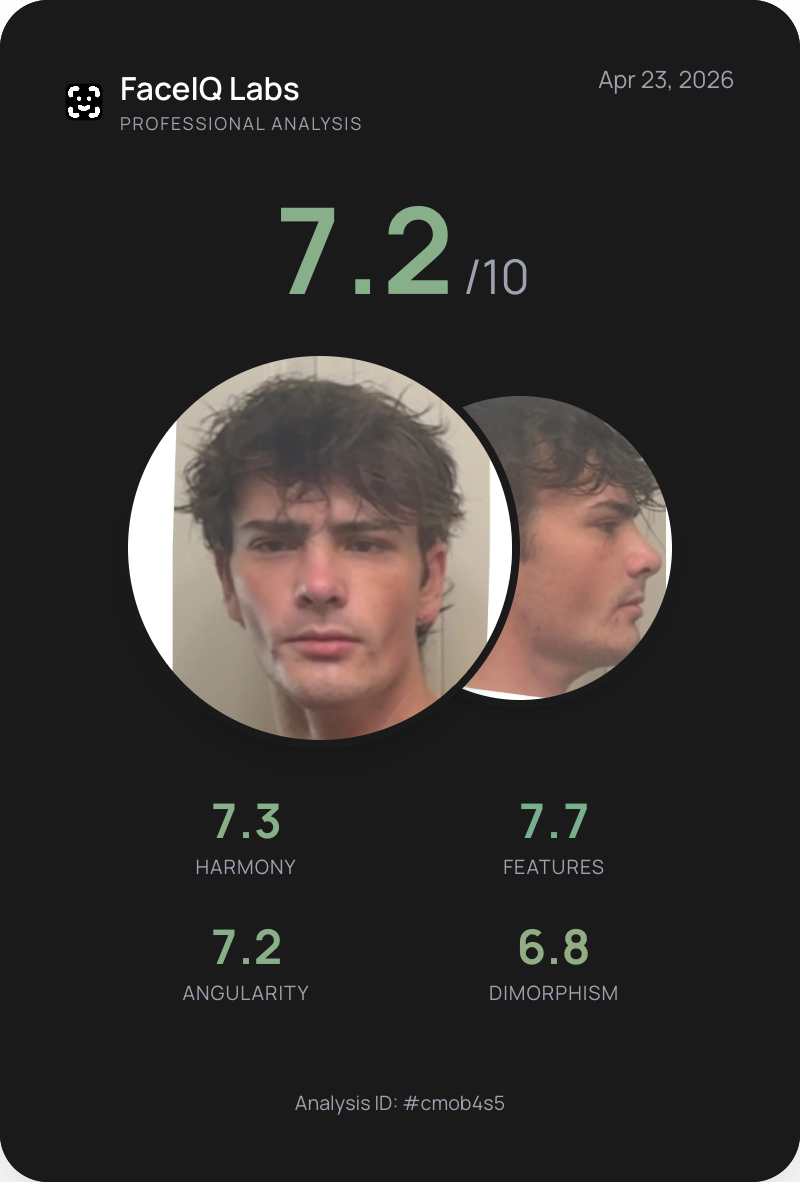 Faceiq score card cmob4s5r00aae1odt7c1qj3z8