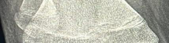 1777050536513