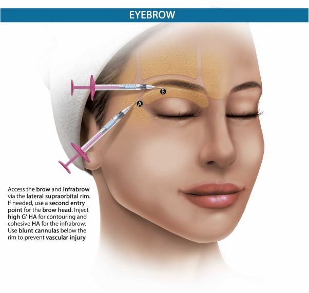 1 s20 S174868152500302X gr2