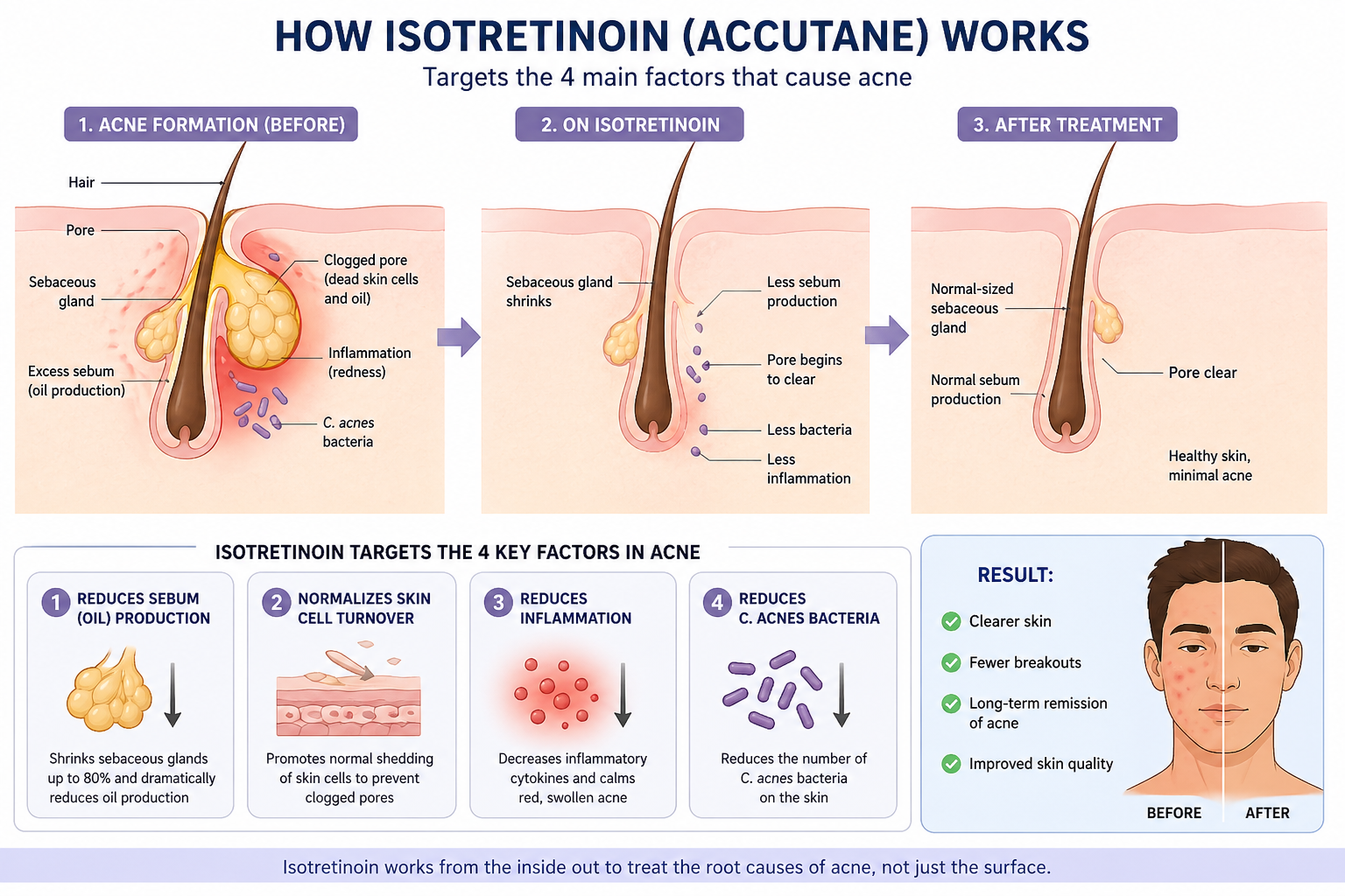 3DD05BDD 2BCE 4BBB B8FD ADE25F3C569D