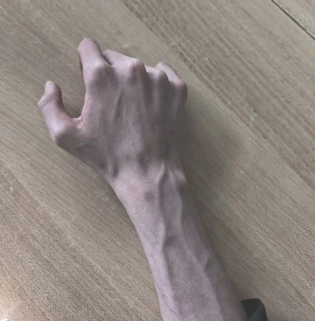 1000097249
