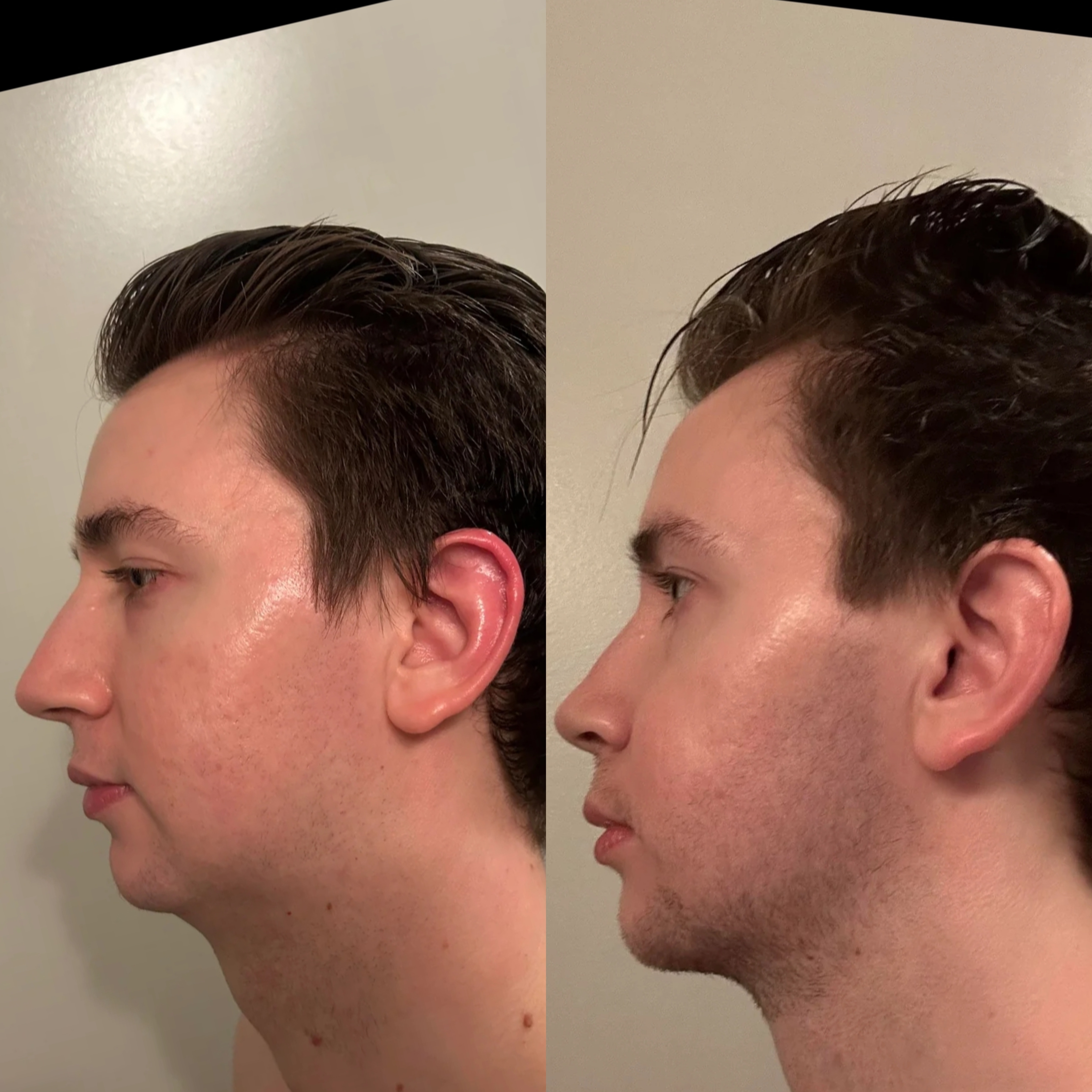 B612 20260427 135824 331