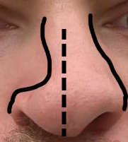 Concave1