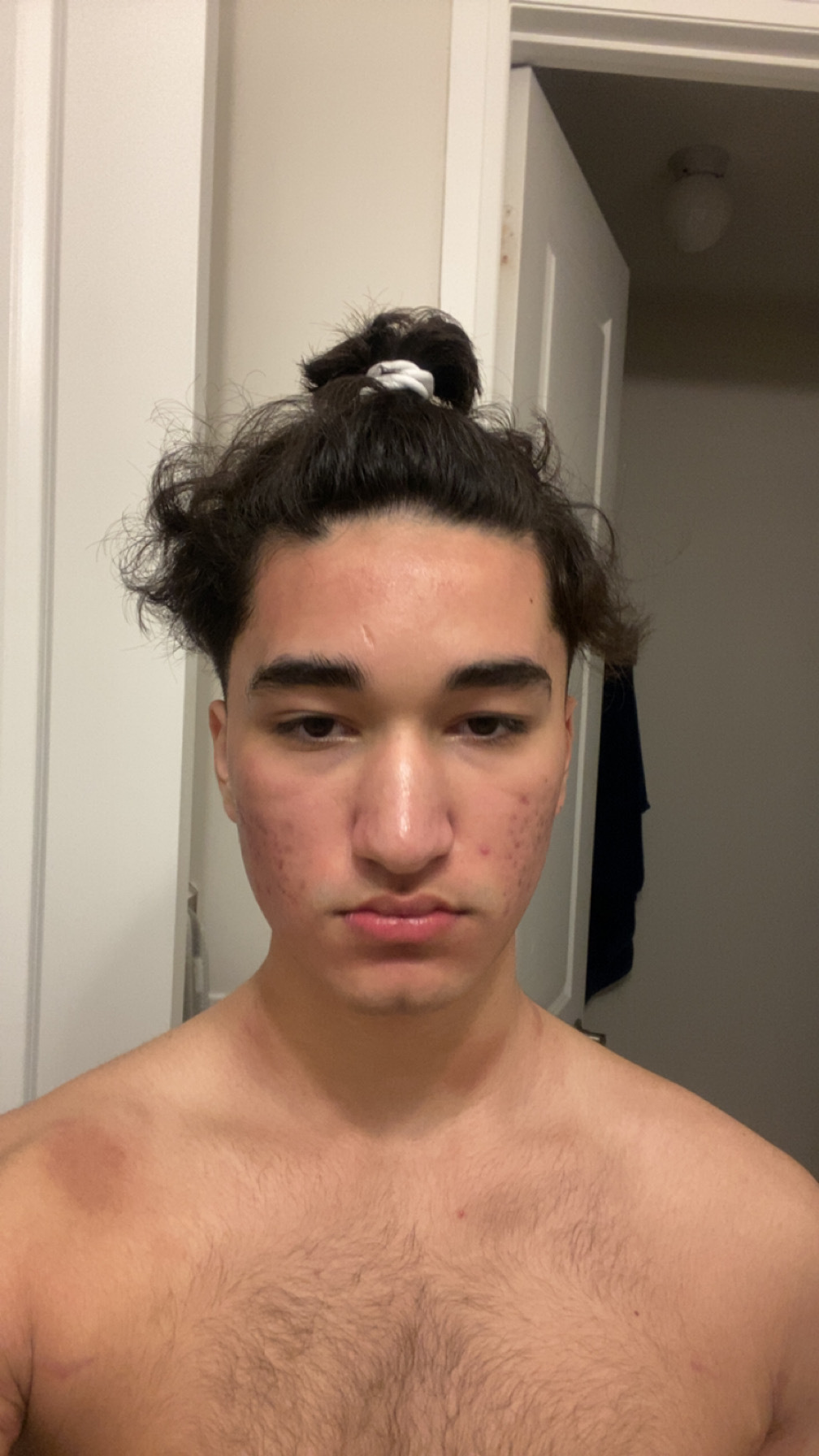 IMG 2562