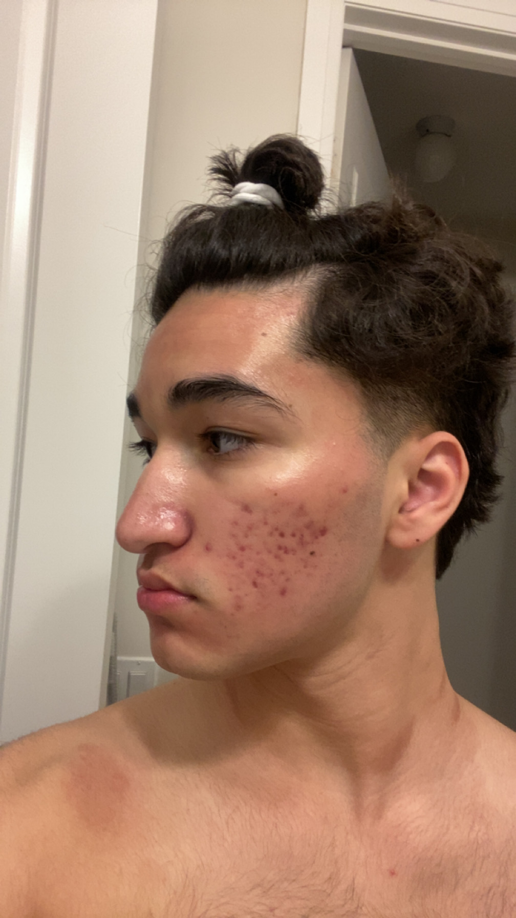 IMG 2564