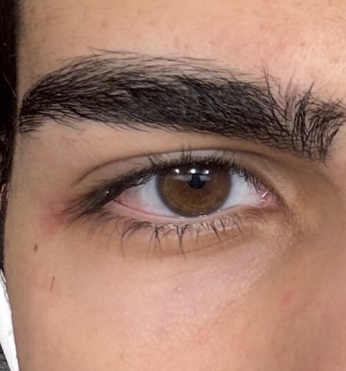 eye area.jpg