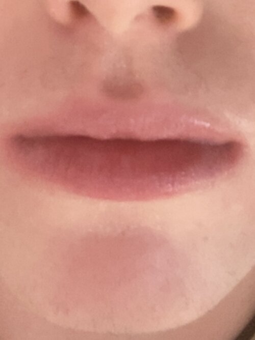 IMG 1081