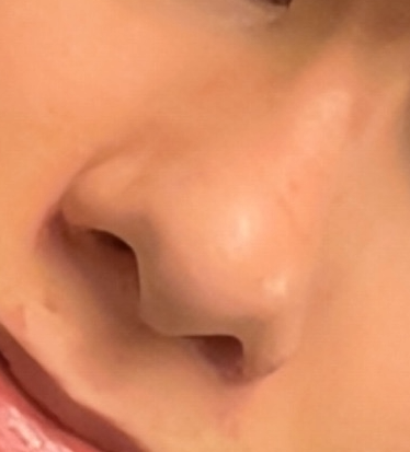 beforenose.png