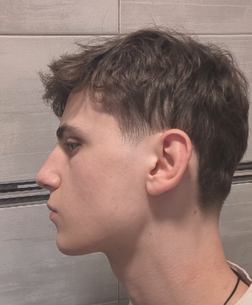 Tell me if I'm recessed. Evaluate infras please. | Looksmax.org - Men's ...
