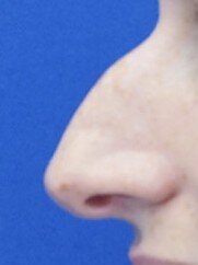6006-imageset_1-before.jpg
