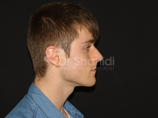 2270897_33.1-before.jpg