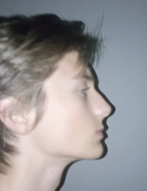 Screenshot_2026-04-14-23-22-50-706_com.zhiliaoapp.musically-edit.jpg