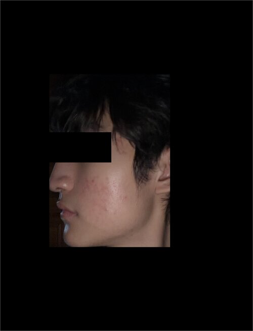 true right after.jpg