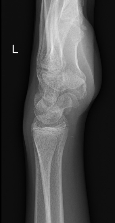 xray3.png