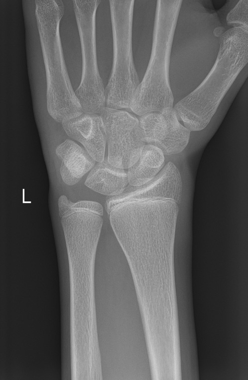 xray2.png