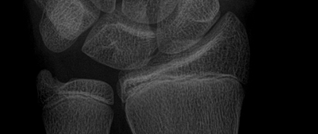 xray1.png