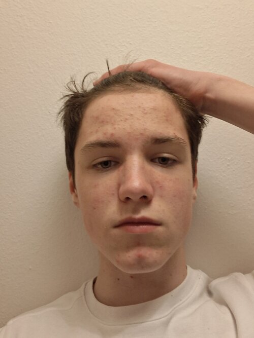 20260417_211018.jpg