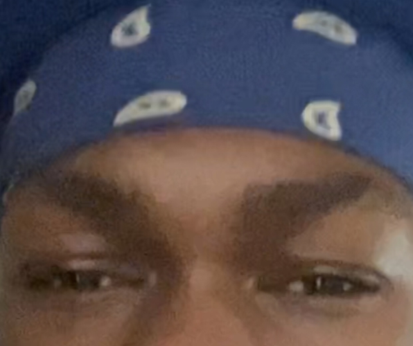 speedy's frauded eye area.png