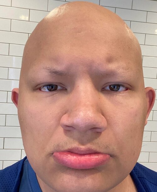 Screenshot 20260427 102912 Reddit