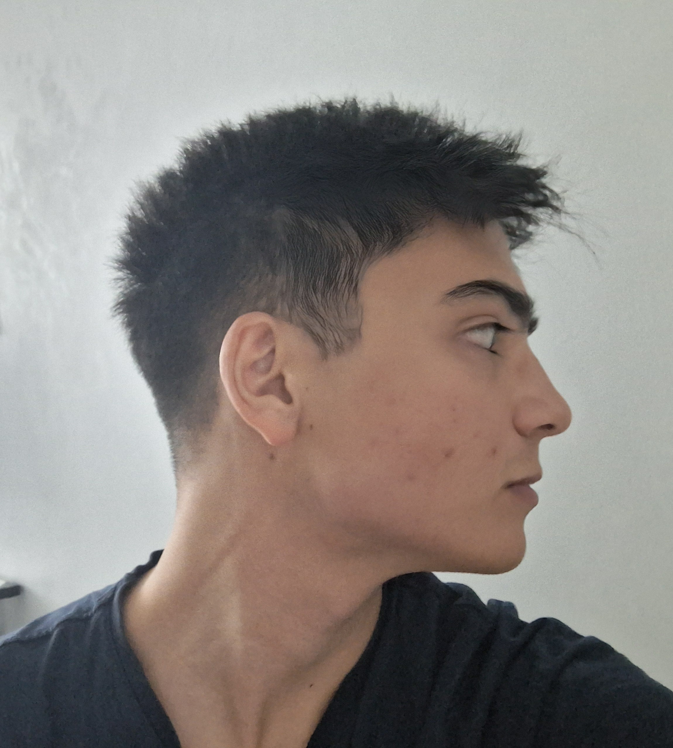 1000036193