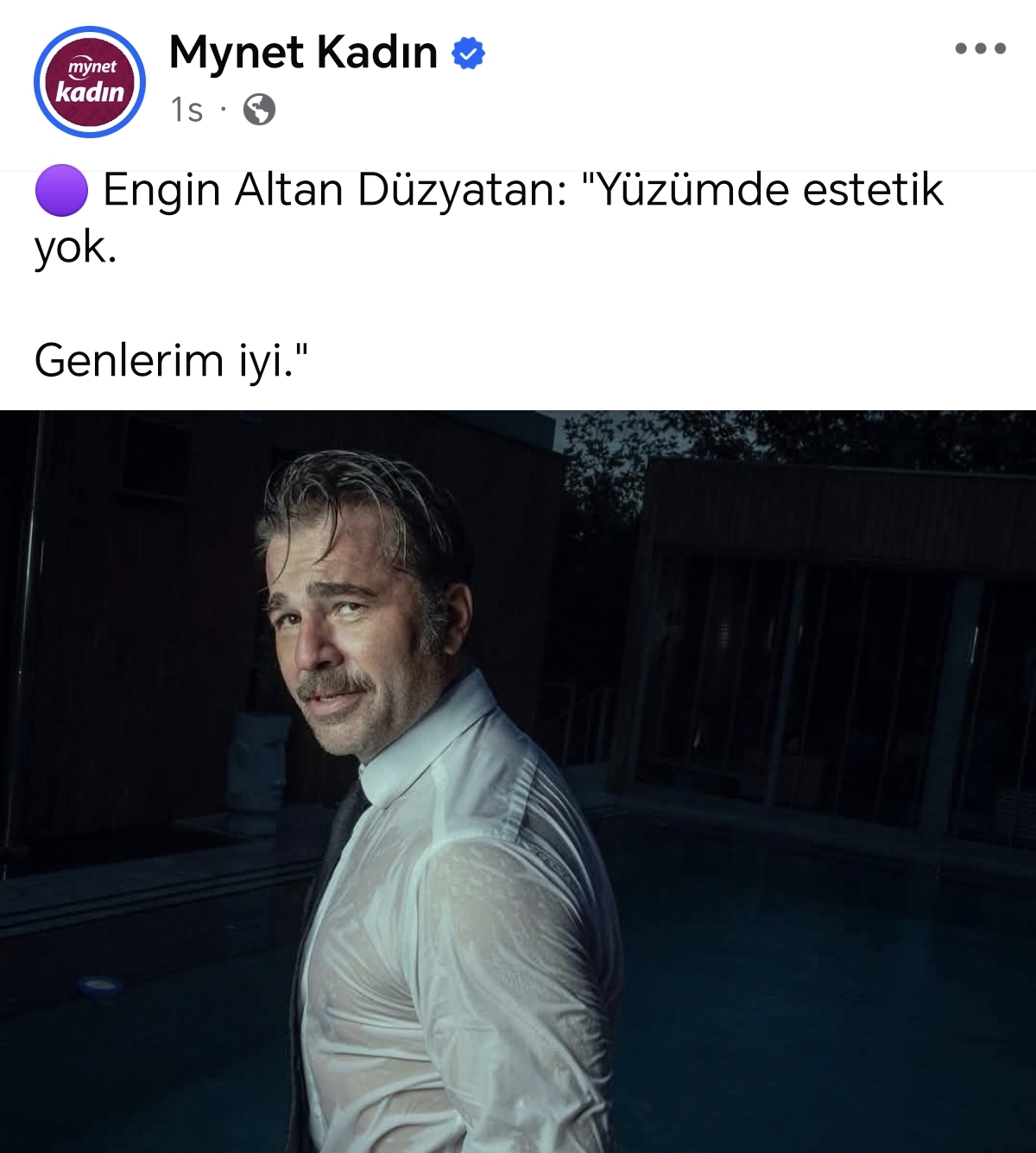 1000055844