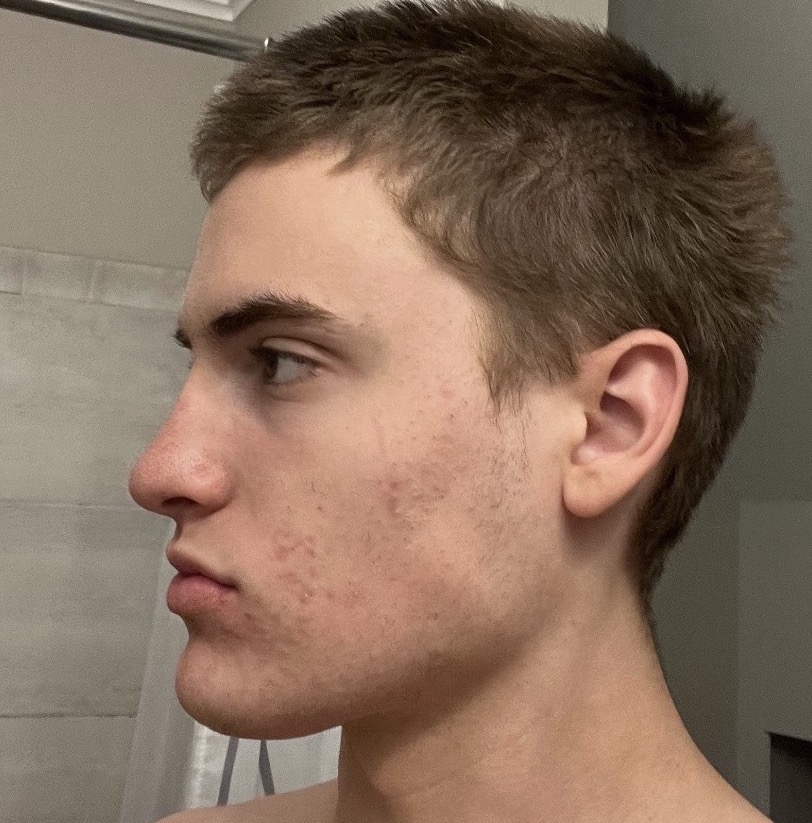 IMG 1006