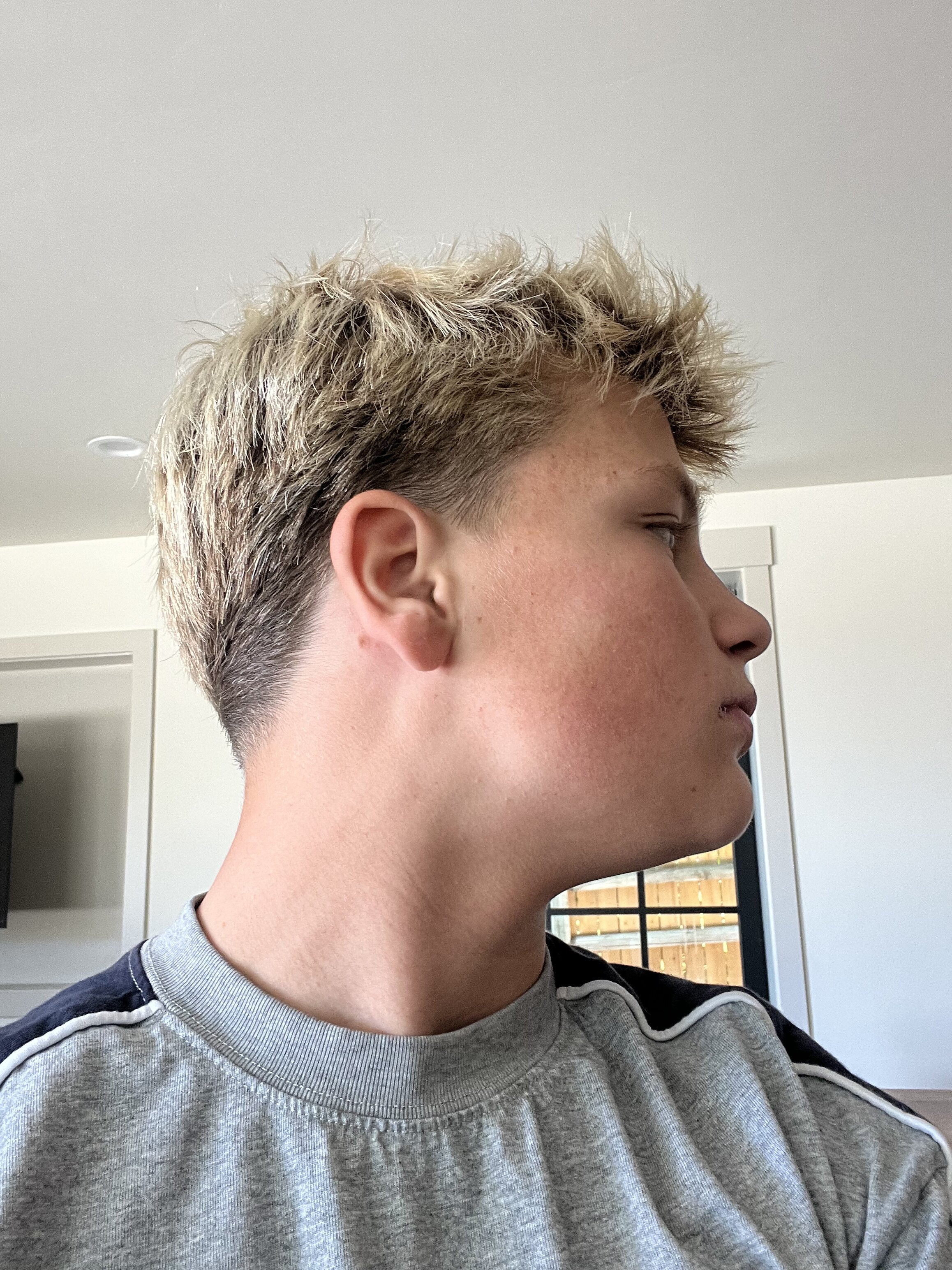 IMG 2649