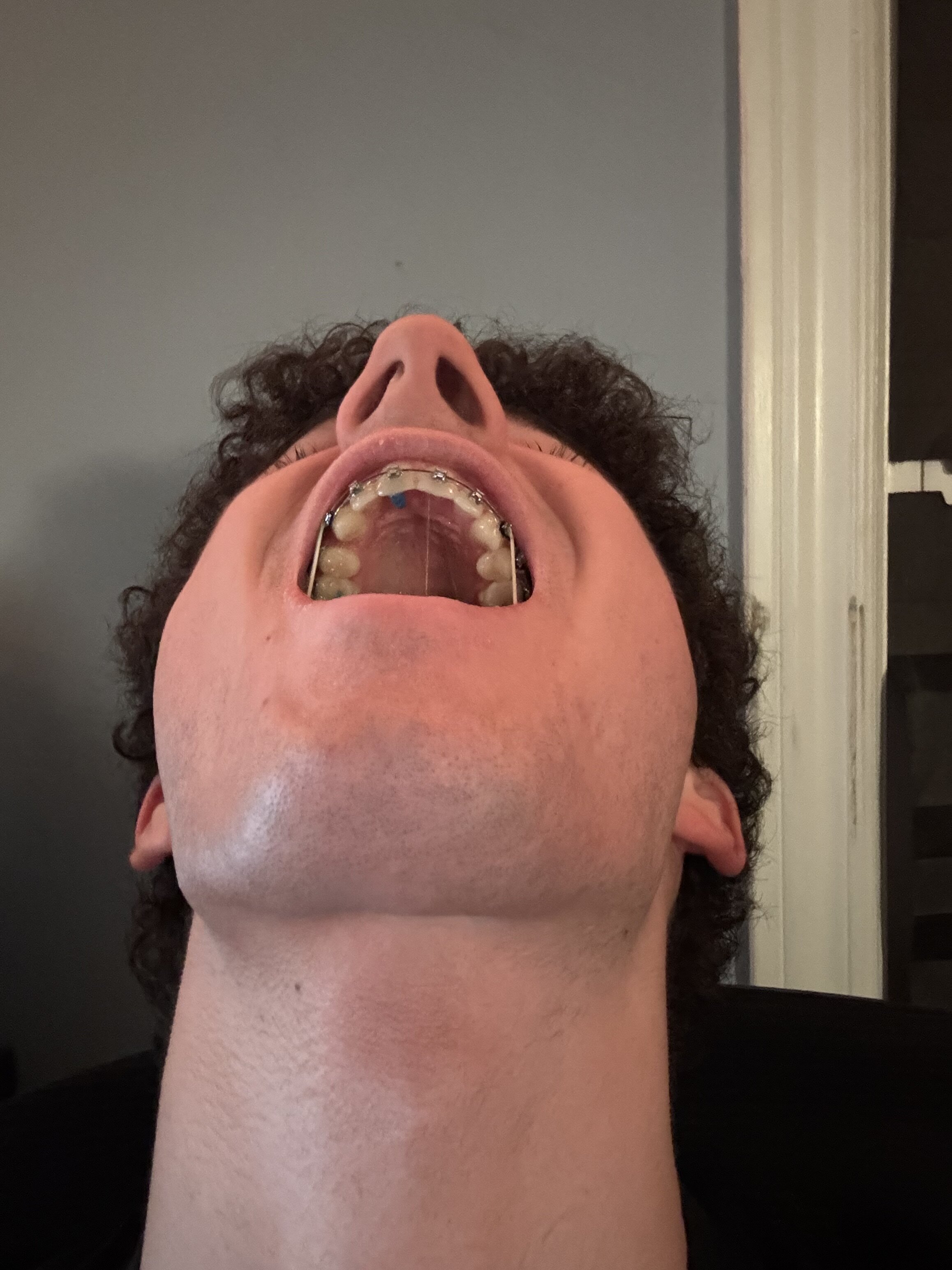 IMG 0929